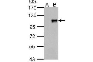 WB Image FOXM1 antibody detects FOXM1 protein by Western blot analysis.