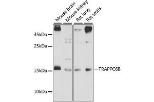 Western blot analysis of extracts of various cell lines, using TRAPPC6B antibody (ABIN6293632) at 1:1000 dilution. (TRAPPC6B Antikörper)