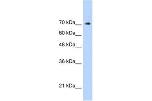 Western Blotting (WB) image for anti-Signal Transducer and Activator of Transcription 1, 91kDa (STAT1) antibody (ABIN2461817) (STAT1 Antikörper)