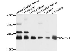 Western blot analysis of extracts of various cell lines, using CACNG1 antibody (ABIN4903103) at 1:1000 dilution.