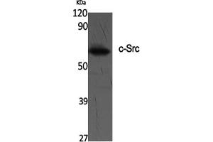 Western Blotting (WB) image for anti-Proto-oncogene tyrosine-protein kinase Src (Src) (Tyr419) antibody (ABIN5961533) (Src Antikörper  (Tyr419))