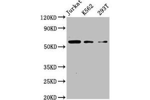 Western Blot Positive WB detected in: Jurkat whole cell lysate, K562 whole cell lysate, 293T whole cell lysate All lanes: CFLAR antibody at 4 μg/mL Secondary Goat polyclonal to rabbit IgG at 1/50000 dilution Predicted band size: 56, 26, 42, 28, 52, 51, 40, 31, 35, 53, 34, 24, 50, 45 kDa Observed band size: 56 kDa (FLIP Antikörper  (AA 1-250))