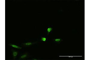 Immunofluorescence (IF) image for anti-Paraneoplastic Antigen MA2 (PNMA2) (AA 1-364) antibody (ABIN524136)