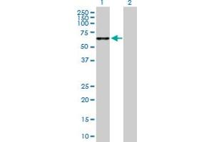 Western Blot analysis of TPTE expression in transfected 293T cell line by TPTE MaxPab polyclonal antibody. (TPTE Antikörper  (AA 1-533))