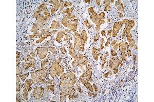 IHC analysis of PPA1 using anti-PPA1 antibody (ABIN6719527).