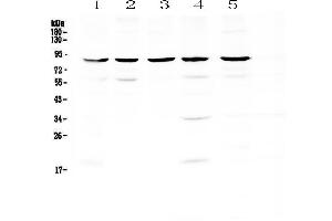 Western blot analysis of NADPH oxidase 4 using anti-NADPH oxidase 4 antibody . (NADPH Oxidase 4 Antikörper)