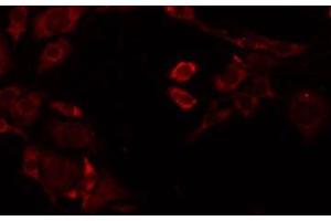 ABIN6277898 staining Hela by IF/ICC. (Renin Antikörper  (Internal Region))