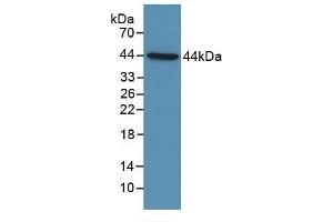 Detection of Recombinant C4d, Human using Polyclonal Antibody to Complement Component 4d (C4d) (Complement C4d Antikörper  (AA 958-1335))