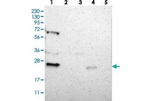 Western blot analysis of Lane 1: RT-4, Lane 2: Human Plasma, Lane 3: U-251 MG, Lane 4: Liver, Lane 5: Tonsil with PRRG4 polyclonal antibody . (PRRG4 Antikörper)