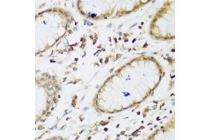 Immunohistochemistry of paraffin-embedded human gastric using UBE3A antibody. (ube3a Antikörper  (AA 300-590))