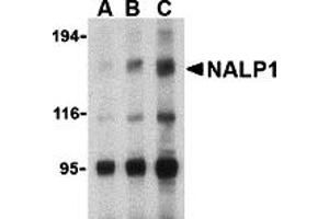 Western Blotting (WB) image for anti-NLR Family, Pyrin Domain Containing 1 (NLRP1) (C-Term) antibody (ABIN1030530) (NLRP1 Antikörper  (C-Term))