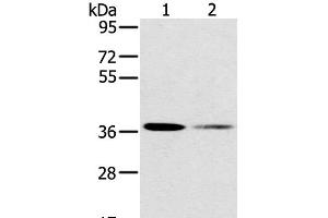 Western Blot analysis of 293T and Raji cell using SMN1 Polyclonal Antibody at dilution of 1:200 (SMN1 Antikörper)