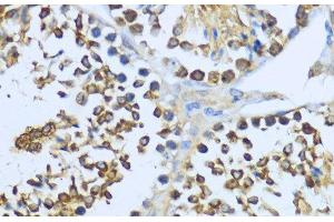 Immunohistochemistry of paraffin-embedded Mouse testis using HSP90AA1 Polyclonal Antibody at dilution of 1:200 (40x lens). (HSP90AA1 Antikörper)
