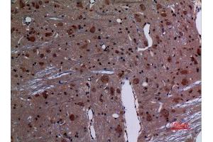 Immunohistochemistry (IHC) analysis of paraffin-embedded Rat Brain, antibody was diluted at 1:100. (RAB26 Antikörper  (C-Term))