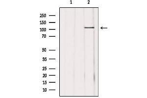 Western blot analysis of extracts from mouse brain, using USP11 Antibody.