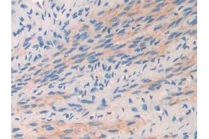DAB staining on IHC-P; Samples: Mouse Oviduct Tissue (COL2A1 Antikörper  (AA 1307-1383))