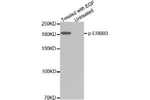 Western blot analysis of extracts from A431 cells using Phospho-ERBB3-Y1328 Antibody (ERBB3 Antikörper  (pTyr1328))
