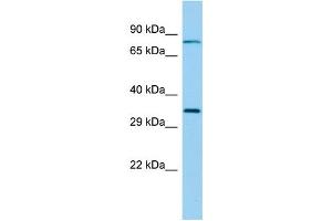 Host: Rabbit Target Name: RSPH9 Sample Type: Fetal Lung lysates Antibody Dilution: 1. (RSPH9 Antikörper  (Middle Region))