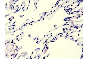 Immunohistochemical staining of paraffin-embedded lung using anti-AKT3 (ABIN2452528) mouse monoclonal antibody. (AKT3 Antikörper)