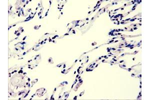Immunohistochemical staining of paraffin-embedded lung using anti-AKT3 (ABIN2452528) mouse monoclonal antibody.