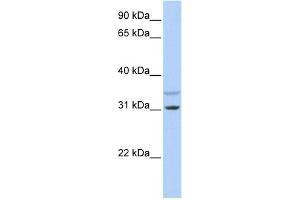 WB Suggested Anti-KCNRG Antibody Titration:  0. (KCNRG Antikörper  (N-Term))