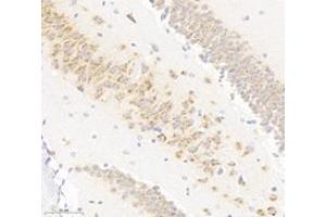Immunohistochemistry analysis of paraffin-embedded mouse hippocampus using VAMP4 (ABIN7076198) at dilution of 1: 3000