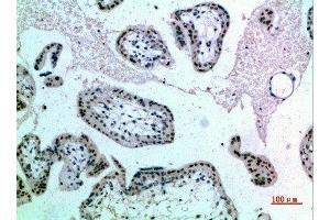 Immunohistochemical analysis of paraffin-embedded human-placenta, antibody was diluted at 1:200 (NOP56 Antikörper  (AA 191-240))