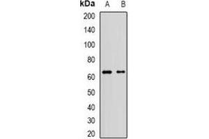 Western blot analysis of AF9 expression in Jurkat (A), A549 (B) whole cell lysates. (AF9 Antikörper)