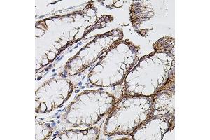 Immunohistochemistry of paraffin-embedded human stomach using MMP9 antibody (ABIN7268426) at dilution of 1:100 (40x lens).
