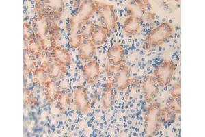 Used in DAB staining on fromalin fixed paraffin- embedded Kidney tissue (PLXNB1 Antikörper  (AA 1598-1849))