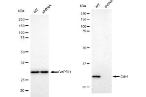 Western blotting analysis using Cdk4 antibody (ABIN7798214). (Rekombinanter CDK4 Antikörper)