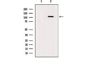 Western blot analysis of extracts from rat brain, using TLR8  Antibody.