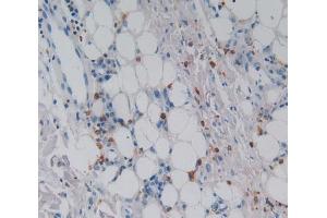 Used in DAB staining on fromalin fixed paraffin- embedded skin cancer tissue