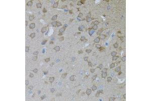 Immunohistochemistry of paraffin-embedded mouse brain using ARF1 antibody. (ARF1 Antikörper)
