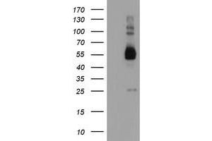 Western Blotting (WB) image for anti-Tubby Like Protein 3 (TULP3) antibody (ABIN1501583) (TULP3 Antikörper)