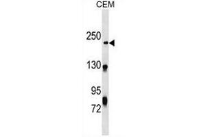 NHSL1 Antibody (Center) (ABIN1538546 and ABIN2849679) western blot analysis in CEM cell line lysates (35 μg/lane). (NHSL1 Antikörper  (AA 632-661))