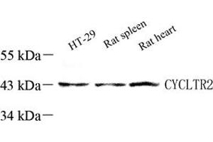 Western blot analysis of CysLT2 (ABIN7073655),at dilution of 1: 60 (CasLTR2 Antikörper)