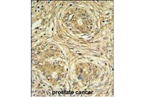 Immunohistochemistry (Paraffin-embedded Sections) (IHC (p)) image for anti-Suppressor of Var1, 3-Like 1 (SUPV3L1) (AA 93-121), (N-Term) antibody (ABIN1881857)