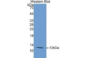 Western Blotting (WB) image for anti-Interleukin 12 Receptor, beta 2 (IL12RB2) (AA 559-647) antibody (ABIN3207283) (IL12RB2 Antikörper  (AA 559-647))