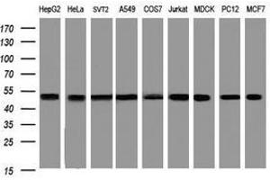 Image no. 5 for anti-SERPINE1 mRNA Binding Protein 1 (SERBP1) (AA 1-262) antibody (ABIN1490676) (SERBP1 Antikörper  (AA 1-262))