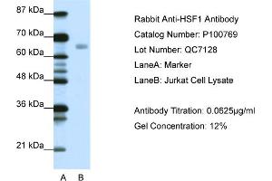 Western Blotting (WB) image for anti-Heat Shock Factor Protein 1 (HSF1) (C-Term) antibody (ABIN2792576)