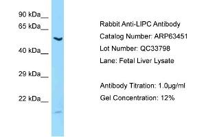 Western Blotting (WB) image for anti-Lipase, Hepatic (LIPC) (C-Term) antibody (ABIN2789506) (LIPC Antikörper  (C-Term))