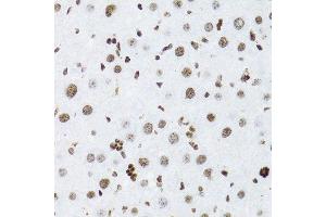 Immunohistochemistry of paraffin-embedded rat liver using NFKB2 Antibody. (NFKB2 Antikörper  (AA 690-899))