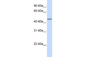 WB Suggested Anti-MAP2K2 Antibody Titration:  1 ug/ml  Positive Control:  HepG2 cell lysate There is BioGPS gene expression data showing that MAP2K2 is expressed in HepG2 (MEK2 Antikörper  (N-Term))