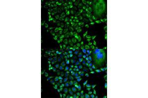 Immunofluorescence analysis of HeLa cell using PSMD10 antibody. (PSMD10 Antikörper  (AA 1-226))