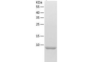 Western Blotting (WB) image for Tumor Necrosis Factor Receptor Superfamily, Member 12A (TNFRSF12A) (AA 28-80) protein (His tag) (ABIN7125548)