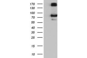 HEK293T cells were transfected with the pCMV6-ENTRY control (Left lane) or pCMV6-ENTRY CAPN9 (Right lane) cDNA for 48 hrs and lysed. (Calpain 9 Antikörper)