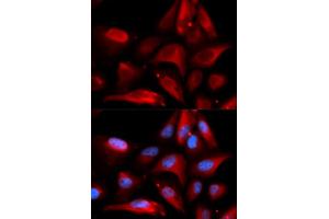 Immunofluorescence analysis of U2OS cells using S100A11 antibody (ABIN5973196). (S100A11 Antikörper)