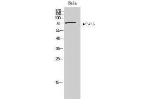 Western Blotting (WB) image for anti-Solute Carrier Family 27 (Fatty Acid Transporter), Member 5 (SLC27A5) (Internal Region) antibody (ABIN3183156) (SLC27A5 Antikörper  (Internal Region))