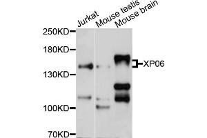 Western blot analysis of extracts of various cell lines, using XPO6 antibody (ABIN4905638) at 1:1000 dilution. (Exportin 6 Antikörper)